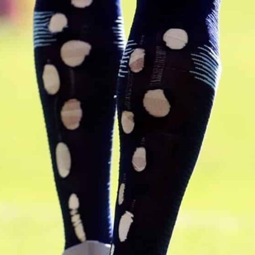 Image de l'article Pourquoi des joueurs font des trous dans leurs chaussettes au niveau des mollets ?