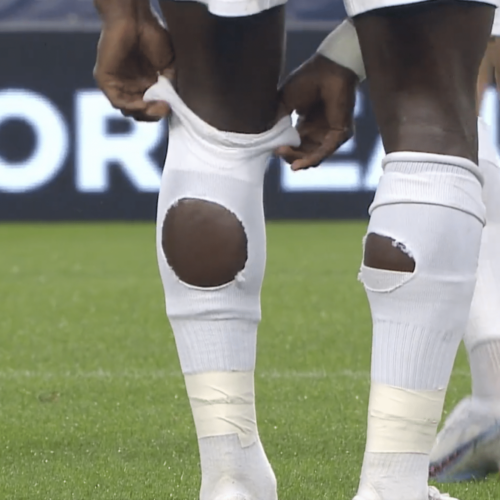 Image de l'article Ligue 2 : les chaussettes trouées posent problème